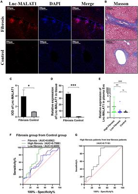 Long Noncoding RNA Metastasis-Associated Lung Adenocarcinoma Transcript 1 in Extracellular Vesicles Promotes Hepatic Stellate Cell Activation, Liver Fibrosis and β-Catenin Signaling Pathway